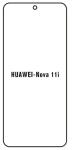 Hydrogel - matná ochranná fólia - Huawei Nova 11i