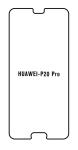 Hydrogel - ochranná fólia - Huawei P20 Pro (case friendly)