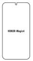 Hydrogel - ochranná fólia - Huawei Honor Magic4 (case friendly)