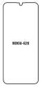 Hydrogel - ochranná fólia - Nokia G20 (case friendly)